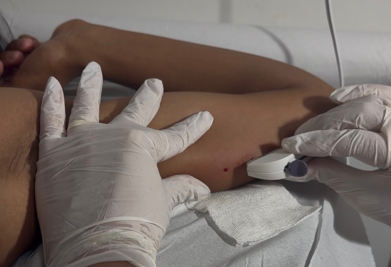 Rede pública implanta 327 métodos contraceptivos em Primavera do Leste