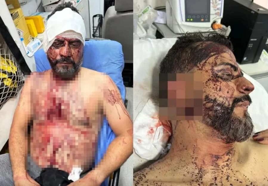 Vereador torturado volta a hospital em Rondonópolis com fortes dores